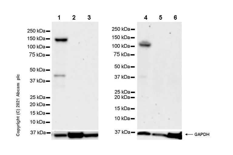 Western blot - Anti-BRDT antibody [EPR25427-24] (AB288435)