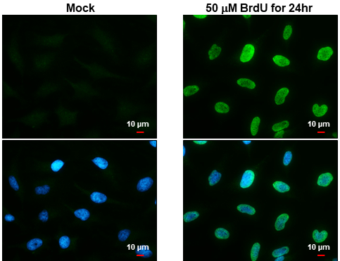 Immunocytochemistry/ Immunofluorescence - Anti-BrdU antibody (AB152095), expandable thumbnail