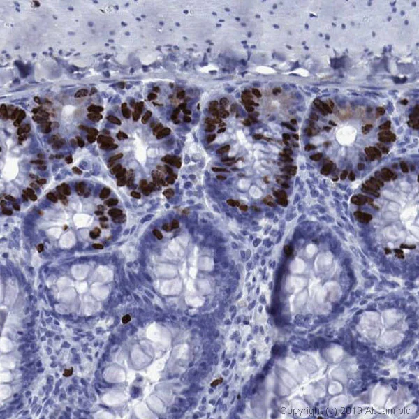 Immunohistochemistry (Formalin/PFA-fixed paraffin-embedded sections) - Anti-BrdU antibody [BU1/75 (ICR1)] - BSA and Azide free (AB264079)