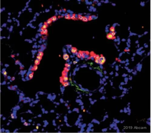 Immunohistochemistry (Formalin/PFA-fixed paraffin-embedded sections) - Anti-BrdU antibody [BU1/75 (ICR1)] - Proliferation Marker (AB6326)