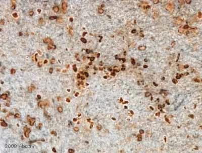 Immunohistochemistry (Formalin/PFA-fixed paraffin-embedded sections) - Anti-BrdU antibody [BU1/75 (ICR1)] - Proliferation Marker (AB6326)