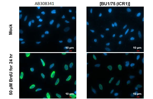 Immunohistochemistry (Formalin/PFA-fixed paraffin-embedded sections) - Anti-BrdU antibody [HL1111] (AB308341)