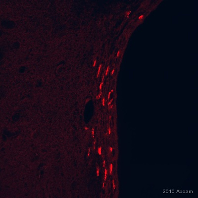 Immunohistochemistry (Formalin/PFA-fixed paraffin-embedded sections) - Anti-BrdU antibody [IIB5] (AB8152), expandable thumbnail