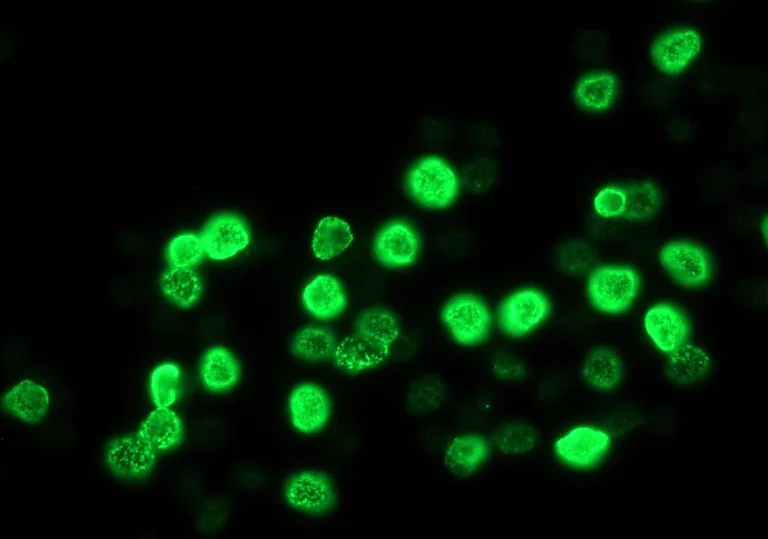 Immunocytochemistry/ Immunofluorescence - Anti-BrdU antibody [IIB5] (AB8955)