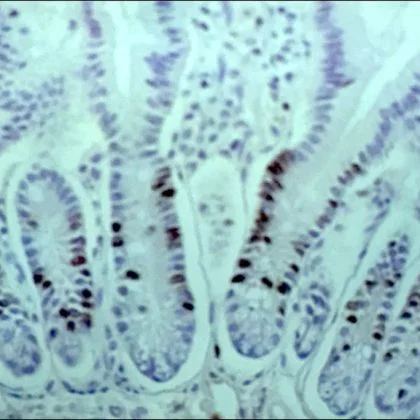 Immunohistochemistry (Formalin/PFA-fixed paraffin-embedded sections) - Anti-BrdU antibody [IIB5] (AB8955)
