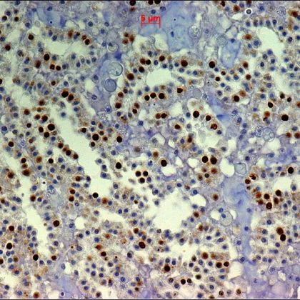 Immunohistochemistry (Formalin/PFA-fixed paraffin-embedded sections) - Anti-BrdU antibody [IIB5] (AB8955)