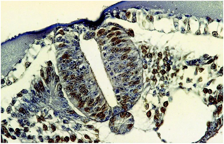 Immunohistochemistry (Formalin/PFA-fixed paraffin-embedded sections) - Anti-BrdU antibody [MoBu-1] (AB8039)