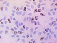 Immunohistochemistry (Formalin/PFA-fixed paraffin-embedded sections) - BrdU Immunohistochemistry Kit (AB125306), expandable thumbnail