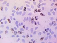 Immunohistochemistry (Formalin/PFA-fixed paraffin-embedded sections) - BrdU Immunohistochemistry Kit (AB125306)