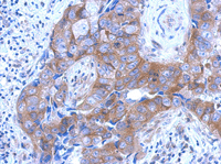 Immunohistochemistry (Formalin/PFA-fixed paraffin-embedded sections) - Anti-Brevican antibody (AB111719), expandable thumbnail