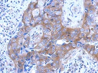 Immunohistochemistry (Formalin/PFA-fixed paraffin-embedded sections) - Anti-Brevican antibody (AB111719)