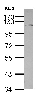 Western blot - Anti-Brevican antibody (AB111719), expandable thumbnail