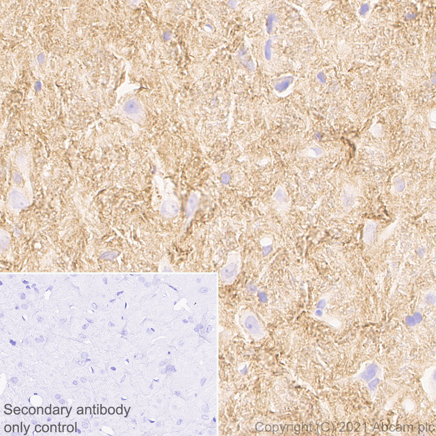 Immunohistochemistry (Formalin/PFA-fixed paraffin-embedded sections) - Anti-Brevican antibody [EPR25743-59] (ab285162), expandable thumbnail