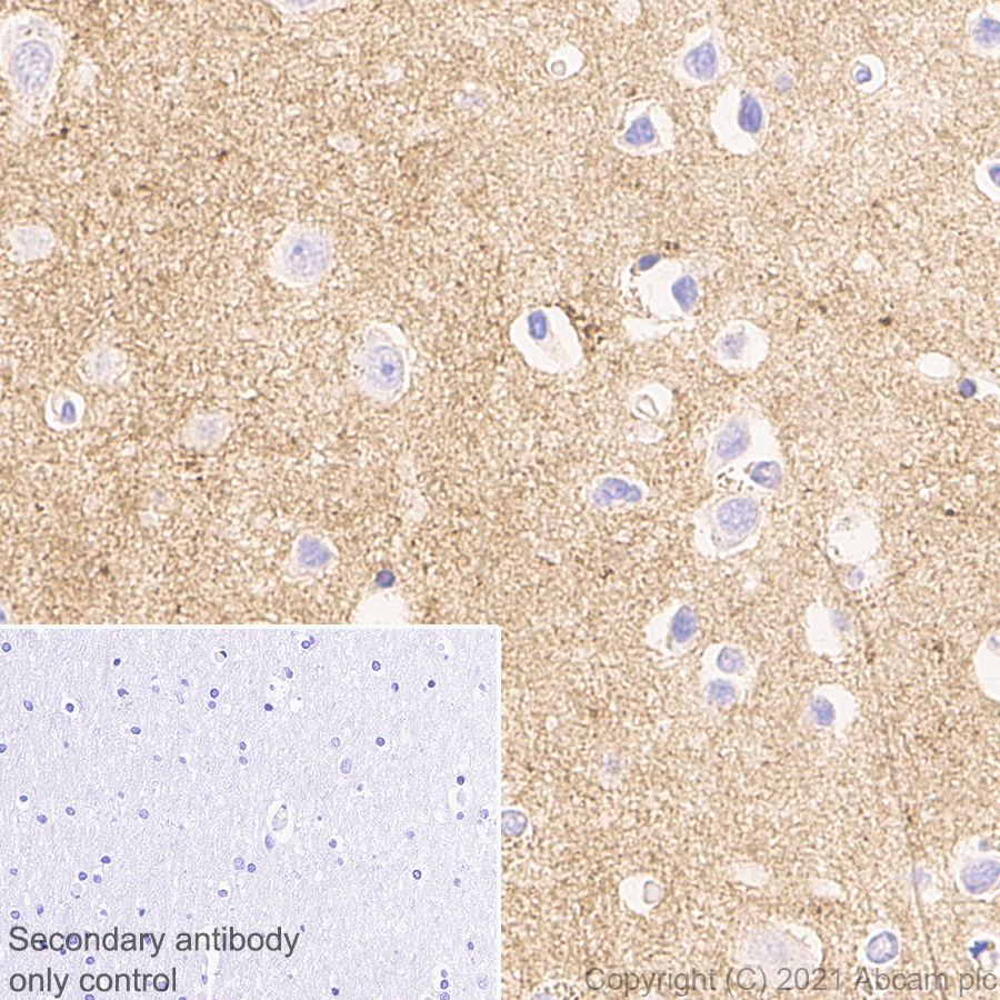 Immunohistochemistry (Formalin/PFA-fixed paraffin-embedded sections) - Anti-Brevican antibody [EPR25743-59] (AB285162), expandable thumbnail