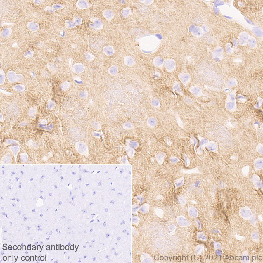 Immunohistochemistry (Formalin/PFA-fixed paraffin-embedded sections) - Anti-Brevican antibody [EPR25743-59] (ab285162), expandable thumbnail
