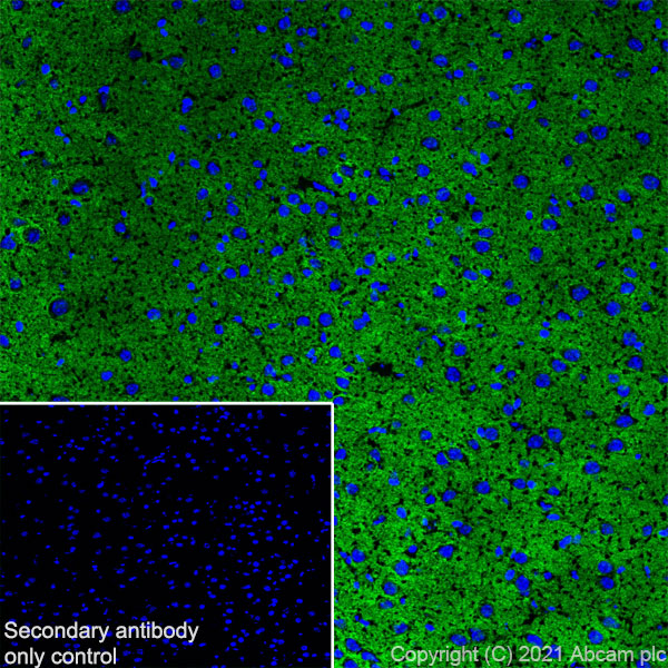 Immunohistochemistry (Frozen sections) - Anti-Brevican antibody [EPR25743-59] (ab285162), expandable thumbnail
