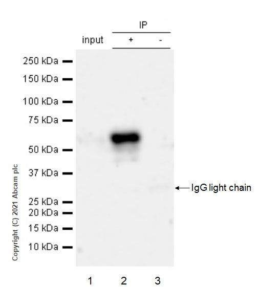Immunoprecipitation - Anti-Brevican antibody [EPR25743-59] (AB285162), expandable thumbnail