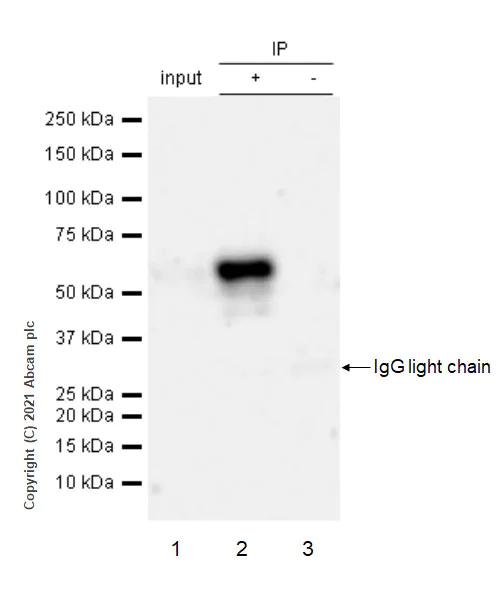 Immunoprecipitation - Anti-Brevican antibody [EPR25743-59] (AB285162)