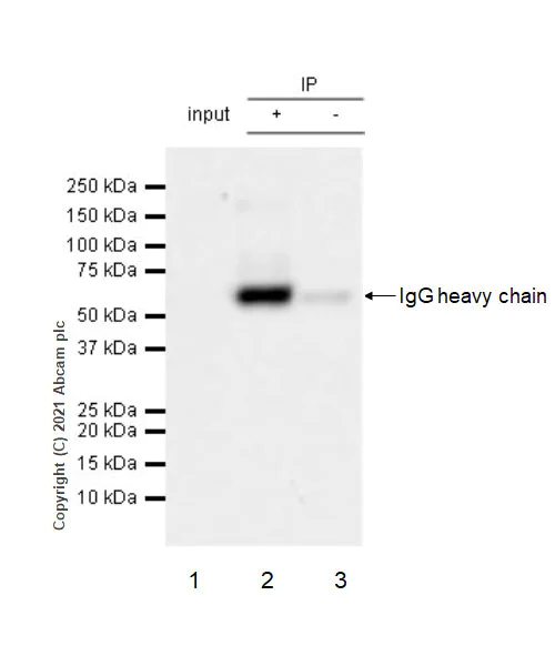 Immunoprecipitation - Anti-Brevican antibody [EPR25743-59] (AB285162)