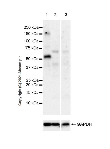 Western blot - Anti-Brevican antibody [EPR25743-59] (ab285162), expandable thumbnail
