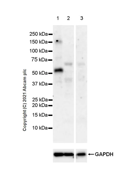 Western blot - Anti-Brevican antibody [EPR25743-59] (AB285162)