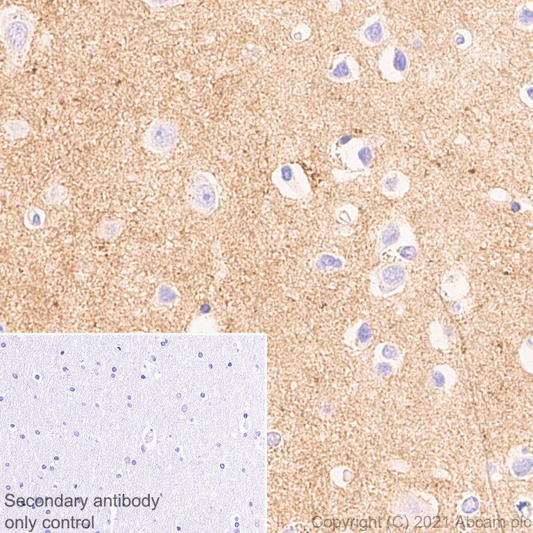 Immunohistochemistry (Formalin/PFA-fixed paraffin-embedded sections) - Anti-Brevican antibody [EPR25743-59] - BSA and Azide free (AB285169)
