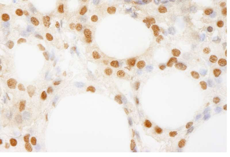 Immunohistochemistry (Formalin/PFA-fixed paraffin-embedded sections) - Anti-BRF1 antibody (AB264191)