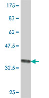 Western blot - Anti-BRF2 antibody - N-terminal (AB194442), expandable thumbnail