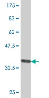 Western blot - Anti-BRF2 antibody - N-terminal (AB194442)