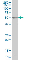 Western blot - Anti-BRF2 antibody - N-terminal (AB194442), expandable thumbnail
