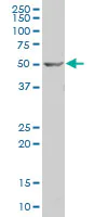 Western blot - Anti-BRF2 antibody - N-terminal (AB194442)