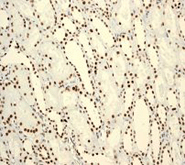 Immunohistochemistry (Formalin/PFA-fixed paraffin-embedded sections) - Anti-BRG1 antibody [EPNCIR111A] (ab110641), expandable thumbnail