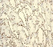 Immunohistochemistry (Formalin/PFA-fixed paraffin-embedded sections) - Anti-BRG1 antibody [EPNCIR111A] (AB110641)