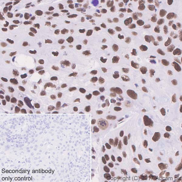 Immunohistochemistry (Formalin/PFA-fixed paraffin-embedded sections) - Anti-BRG1 antibody [EPNCIR111A] (AB110641), expandable thumbnail
