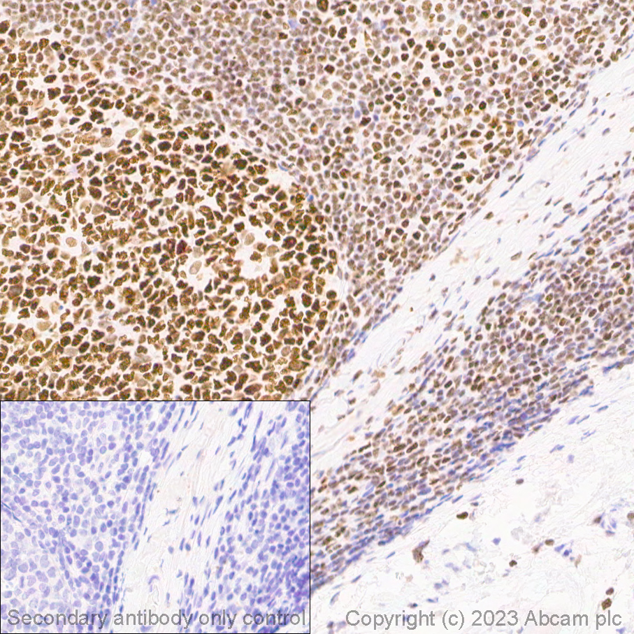 Immunohistochemistry (Formalin/PFA-fixed paraffin-embedded sections) - Anti-BRG1 antibody [EPNCIR111A] (ab110641), expandable thumbnail