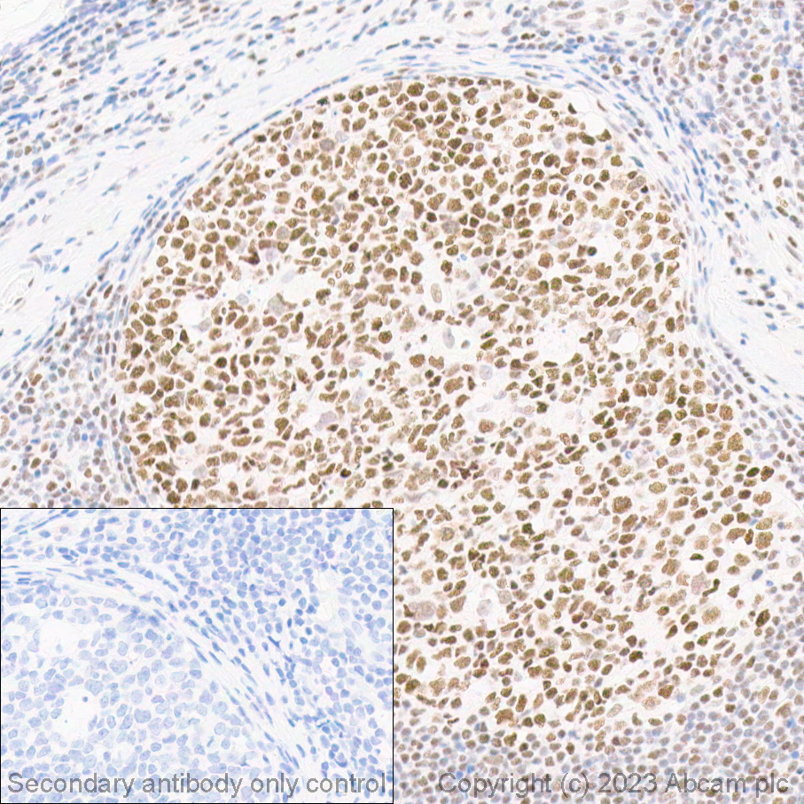 Immunohistochemistry (Formalin/PFA-fixed paraffin-embedded sections) - Anti-BRG1 antibody [EPNCIR111A] (ab110641), expandable thumbnail
