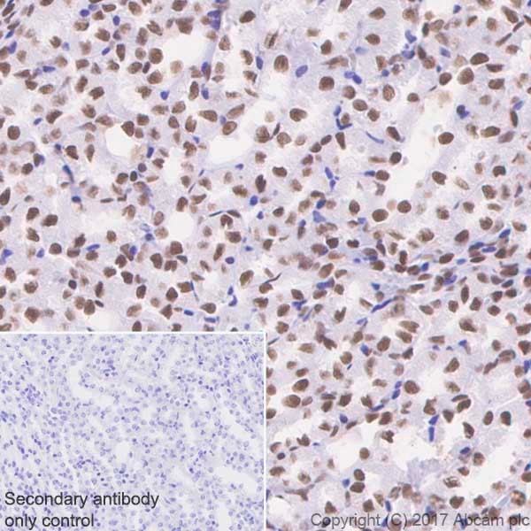 Immunohistochemistry (Formalin/PFA-fixed paraffin-embedded sections) - Anti-BRG1 antibody [EPNCIR111A] (ab110641), expandable thumbnail