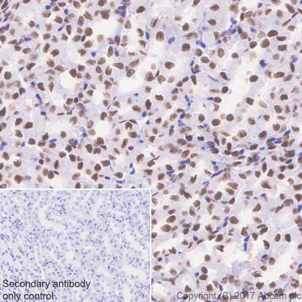 Immunohistochemistry (Formalin/PFA-fixed paraffin-embedded sections) - Anti-BRG1 antibody [EPNCIR111A] (AB110641)