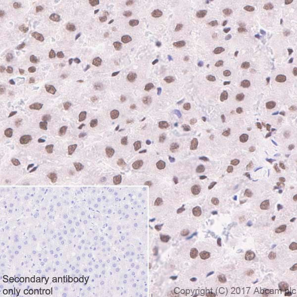 Immunohistochemistry (Formalin/PFA-fixed paraffin-embedded sections) - Anti-BRG1 antibody [EPNCIR111A] (ab110641), expandable thumbnail