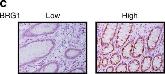 Immunohistochemistry - Anti-BRG1 antibody [EPNCIR111A] (AB110641)