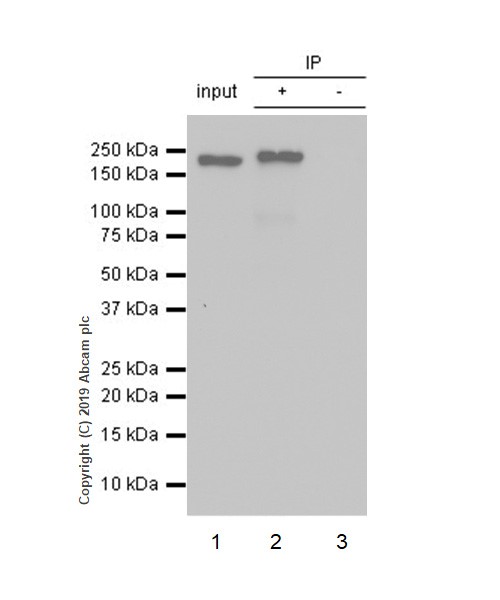 Immunoprecipitation - Anti-BRG1 antibody [EPNCIR111A] (AB110641), expandable thumbnail