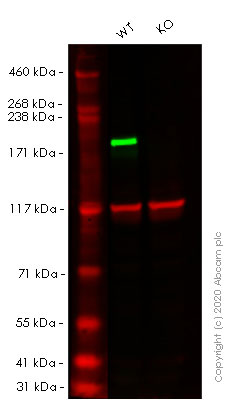 Western blot - Anti-BRG1 antibody [EPNCIR111A] (AB110641), expandable thumbnail