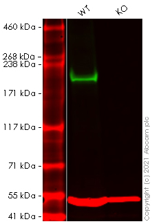 Western blot - Anti-BRG1 antibody [EPNCIR111A] (AB110641), expandable thumbnail