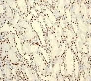 Immunohistochemistry (Formalin/PFA-fixed paraffin-embedded sections) - Anti-BRG1 antibody [EPNCIR111A] - BSA and Azide free (AB215998), expandable thumbnail