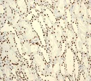 Immunohistochemistry (Formalin/PFA-fixed paraffin-embedded sections) - Anti-BRG1 antibody [EPNCIR111A] - BSA and Azide free (AB215998)