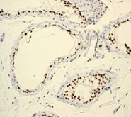 Immunohistochemistry (Formalin/PFA-fixed paraffin-embedded sections) - Anti-BRG1 antibody [EPNCIR111A] - BSA and Azide free (AB215998)