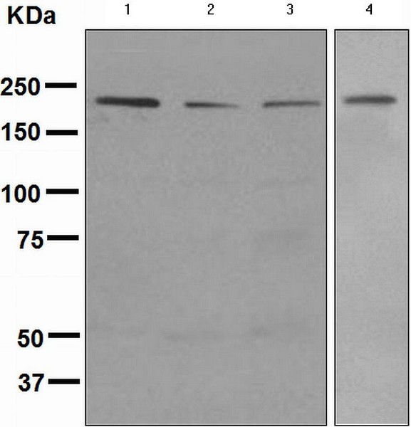 Western blot - Anti-BRG1 antibody [EPNCIR111B] (AB133257), expandable thumbnail