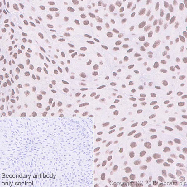 Immunohistochemistry (Formalin/PFA-fixed paraffin-embedded sections) - Anti-BRG1 antibody [EPR3912] (AB108318)