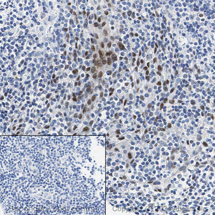Immunohistochemistry (Formalin/PFA-fixed paraffin-embedded sections) - Anti-BRG1 antibody [EPR3912] (ab108318), expandable thumbnail