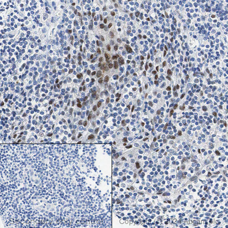 Immunohistochemistry (Formalin/PFA-fixed paraffin-embedded sections) - Anti-BRG1 antibody [EPR3912] (AB108318)